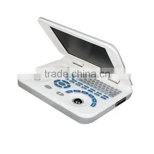 Hot Sale Sony Printer /medical Use Ultrasonic Diagnostic-Large Screen 10.4 Inch Laptop Ultrasound Scanner thumbnail-5