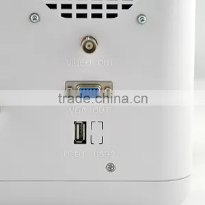 2016 Cheapest Portable Ultrasounic Diagnose Scanner Machine System With Convex/Linear/Cardic/Rectal Transducer Connector thumbnail-6