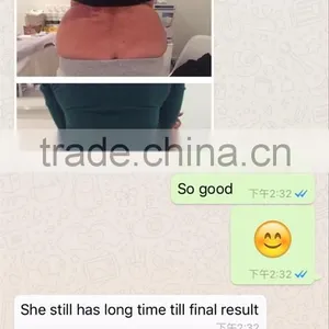 Skin Lifting Bottom Price Cryolipolysis Fat Fat Reduction Freeze Slimming Machine Cool Tech Body Shaping thumbnail-6