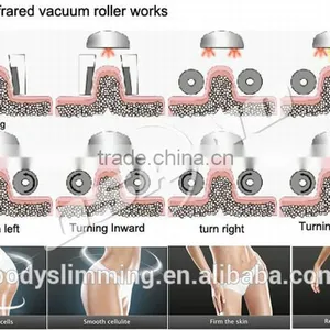 2015 Vacuum Roller Massage Equipment Cool Shape Machine thumbnail-6