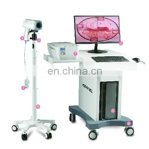 Cheapest Digital Video Colposcope Portable Handheld Video Colposcope thumbnail-2