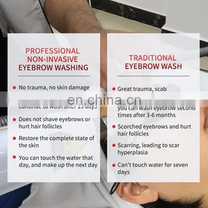 Q Switch ND Yag Laser Machine Non Invasive Tattoo Removal Laser Machine Freckle Eyebrow Pigment Removal Beauty Instrument thumbnail-3