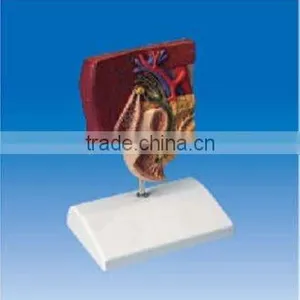Gallstone Model ,Anatomical Modle of Gallstone thumbnail-1
