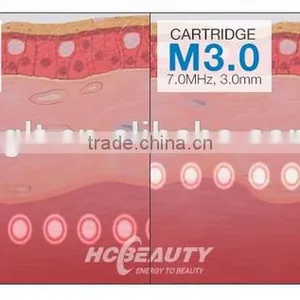 1.0-10mm 2016 Hot Selling Ultrasonic Hifu Vaginal Tightening Machine Skin Tightening thumbnail-6