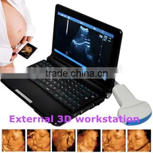 Laptop Ultrasound Scanner Diagnostic Machine + Convex Probe +external 3D Workstation Optional thumbnail-1