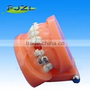 Dental Orthodontic Implant Study Plastic Dental Model of Teeth thumbnail-1
