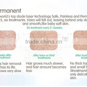 High Effect Vertical Hair Removal Machine Portable Diode Laser Hot Sale thumbnail-5