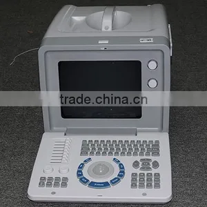 CE ISO Approved 10-inch SVGA High Resolution Full Digital Portable Ultrasound Machine thumbnail-6