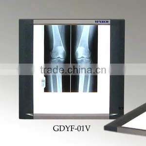 X-Ray Film Viewer thumbnail-1