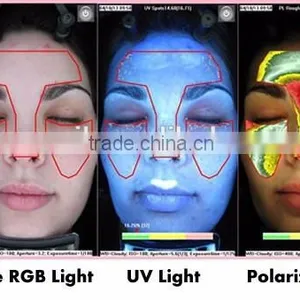 2014 Newest Portable Skin Hair AnalyzerSuitable For Windows 8 and Windows 8.1 thumbnail-4
