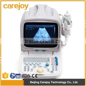 Beautiful Compact Diagnostic Ultrasound Probe / Mini Ultrasound Machine / Portable Ultrasound Scanner thumbnail-1