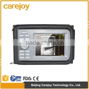 Carejoy Handheld Ultrasound Machine / Scanner With Rechargeable Battery for Obstetrics,Gynecology,Urology and Small Parts thumbnail-1