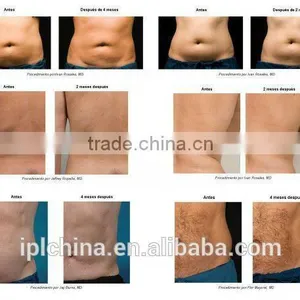 2015 New Vertical Radio Frequency & Pemf Body Slimming Machine - CE thumbnail-6