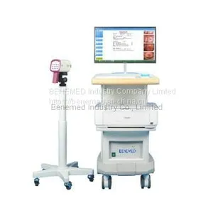 Medical Equipment Digital Video Colposcope for Gynecology thumbnail-1