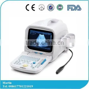 Lowe Price Medical Equipment Portable Cheap Ultrasound Scanner/Machine 3.5Mhz Multi-frequency Convex Probe thumbnail-1