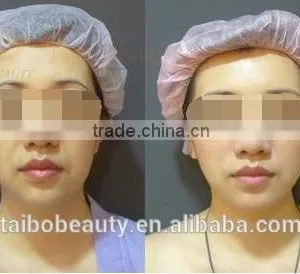 Spa Wanted Best Selling of Skin Lightening and Whitening Machine With Diamond Dermabrasion thumbnail-5