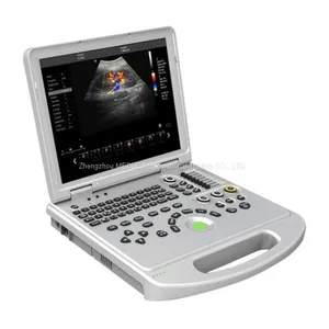Clinic Portable Cardio Echo Ultrasound Scanner Doppler thumbnail-1