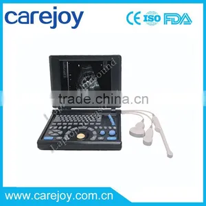 Promotion!!CE Approved Laptop Ultrasound Scanner With 3.5Mhz Multi-frequency Convex Probe RUS-9000E2 thumbnail-1
