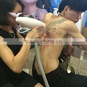 Tattoo Removal Laser Equipment Best Tattoo Face Removal Machine 1064 Q-switched Nd Yag Laser Machine 1-10Hz thumbnail-6
