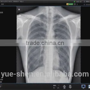 For All Kinds of X-ray Machine Flat Panel Digital X-ray System thumbnail-5