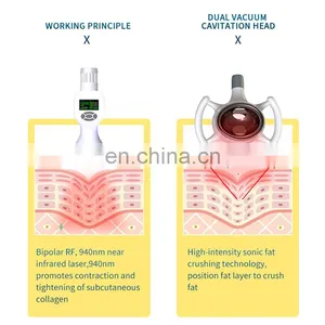 X9 RF Body Shaping Vacuum Fat Dissolving Cavitation Machine Skin Tightening Anti-aging Comprehensive Body Slimming Instrument thumbnail-5
