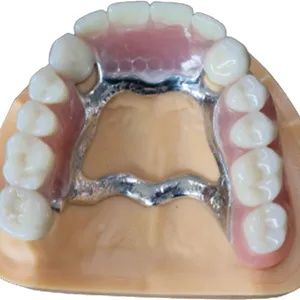 Zirconia All-Ceramic Crowns And Bridges Have No Irritation Or Allergic Reaction To The Gums thumbnail-3