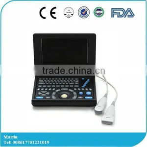 Hot Sale Model!!! PC Based China Factory Low Price Mini Laptop Portable Ultrasound Scanner Two Connectors Medical Price thumbnail-1