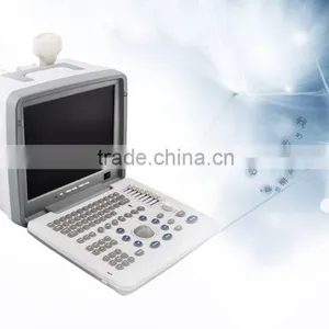 2016 Large Screen Cheapest Portable Ultrasounic Diagnosis Scanner Machine System With Convex/ Linear Transducer and Sony Printer thumbnail-1