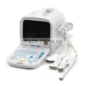 2016 Hot Sale Portable Ultrasonic Diagnostic Devices Type B Ultrasound-RUS-9000A thumbnail-6