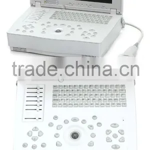 Hospital Clinical Equipment 15-inch Full Digital Laptop Ultrasound Scanner China Made Portable Ultrasound Machine thumbnail-5