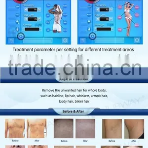 2017 New Design Alexandrite Laser/ Lightsheer Diode Laser/ 808nm Diode Laser Hair Removal Machine With CE thumbnail-3
