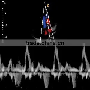 2016 New Portable Color Doppler(Optional 4D) for Cardiac Use thumbnail-2