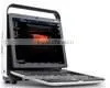 pc Based Ultrasound Scanner Portable Ultrasound Scanner Usb Ultrasound Scanner thumbnail-1