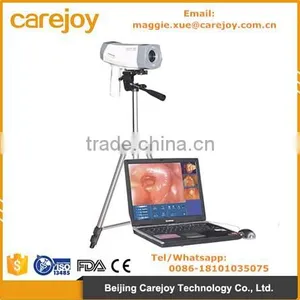 Electronic Colposcope Endoscope for Gynecology Gynaecological Vagina 800,000 Pixels With CCD Sony Camera by CE Certification thumbnail-1