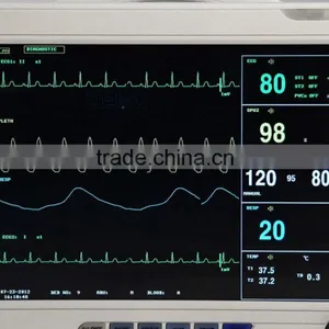 Carejoy 12 Inch Multi-parameter Patient Monitor Optional Printer RPM-9000A for Adult, Pediatrics and Neonate in Hospital ICU CCU thumbnail-3