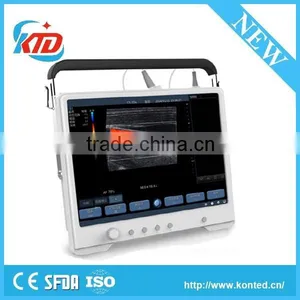 Ultrasound Machine , Color Doppler Ultrasound Machine, Ultrasound Scanner thumbnail-1