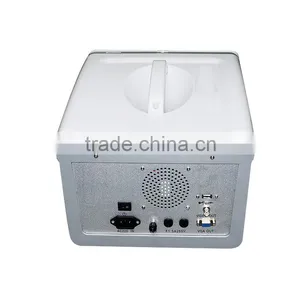 Digital Portable Ultrasound Scanner thumbnail-5