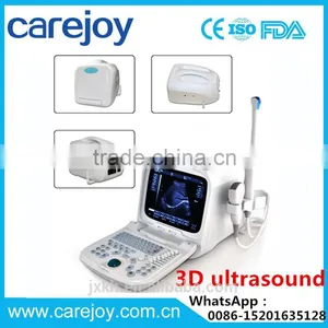 3D Full Digital Portable Ultrasound Scanner With PC Platform thumbnail-1