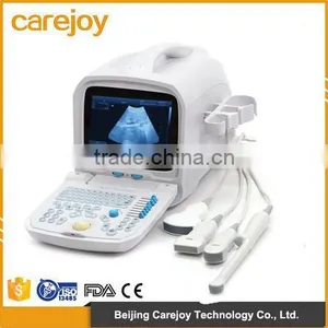New!!! Full Digital Portable Ultrasound Scanner (PC) With Low Price thumbnail-1
