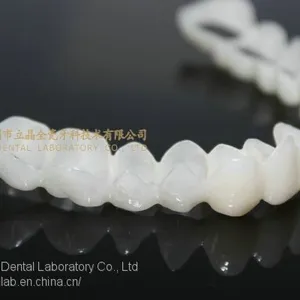CAD/CAM PMMA Resin Clip on Veneers, Snap-on-veneers, Smile Veneers, Laboratoire Dentaire, Dentallabor, Laboratorio Dental, Dental Laboratory, Shenzhen LJ Dental Lab China thumbnail-1