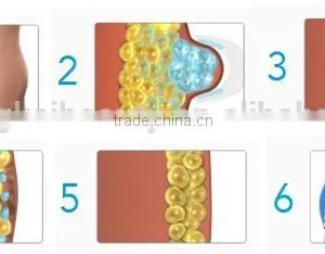 Wholesale China Factory Cool Tech Fat Freezing Slimming Machine thumbnail-5