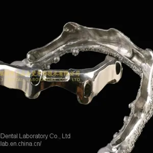Dental Implant Bar, Implant Overdenture, Implant Prosthesis, Laboratoire Dentaire, Dentallabor, Laboratorio Dental, Dental Laboratory, Shenzhen LJ Dental Lab China thumbnail-2