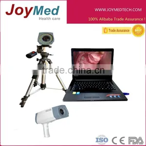 Self Exam Colposcope thumbnail-1
