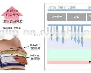 Advanced HIFU Body Slimming for Cellulite Reduction /hifu Double thumbnail-5