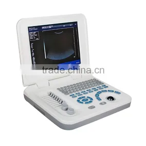 Hot Sale Sony Printer /medical Use Ultrasonic Diagnostic-Large Screen 10.4 Inch Laptop Ultrasound Scanner thumbnail-3