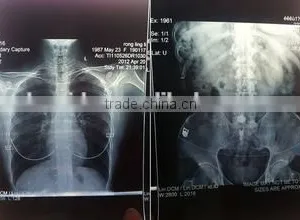 Dry Medical Thermal Dry Film KX410 X-ray Film Dry Film thumbnail-3