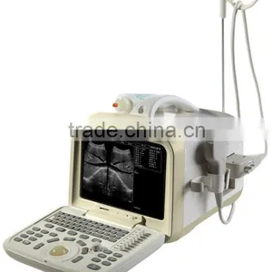 Portable Ultrasound Scanner CE Marked thumbnail-1