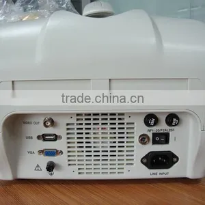 Full Digital Portable Ultrasound Scanner With Convex Linear Probe RUS-6000A Ultrasonic Machine Medical Factory thumbnail-3
