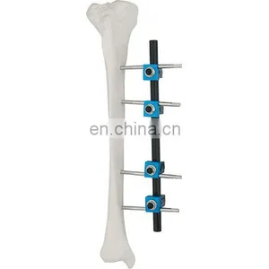 Orthopedic Surgical Instruments Femur&Tibial External Fixator for Femur&Tibia Surgery thumbnail-1