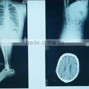 Japan Film Fuji X-ray Film Konica Dry Films thumbnail-6